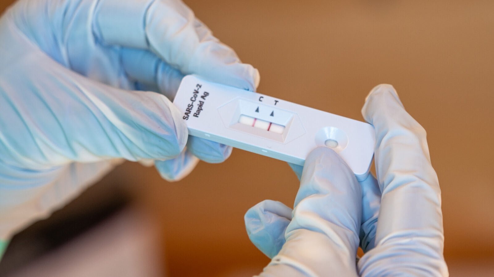 Marca “Covid free” (7 ricoveri), ma più di 200 in ospedale con l’influenza. L’Ulss: “Vaccinatevi”